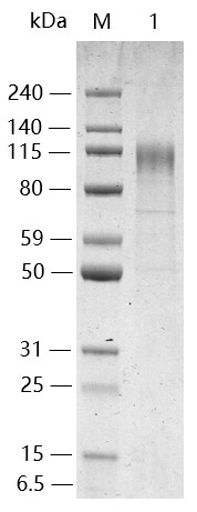 SARS-CoV-2 Spike Protein (S1, E484K, His Tag)